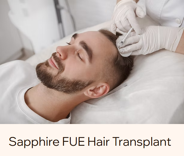 hair-restoration 1